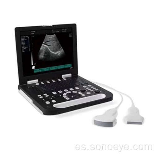 Escáner de ultrasonido de la portátil completo